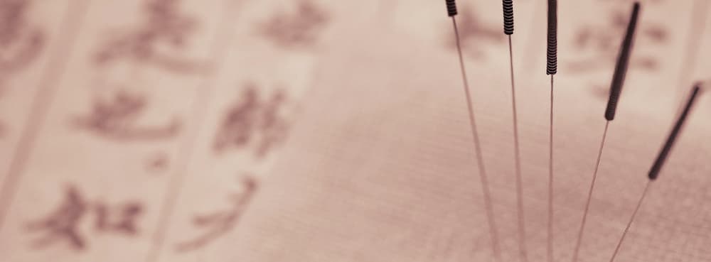 Zhenjiu: Chinese Acupuncture and Moxibustion | Academy of Chinese ...